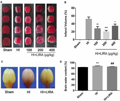 Treatment With Liraglutide Exerts Neuroprotection After Hypoxic–Ischemic Brain Injury in Neonatal Rats via the PI3K/AKT/GSK3β Pathway